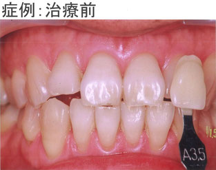 症例:治療前