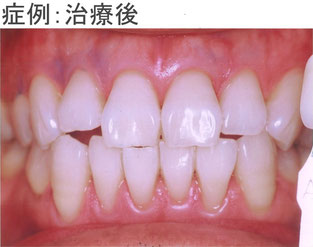 症例:治療後